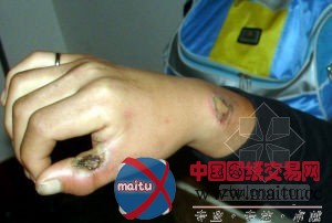 挪动脚手架触电致3死1伤