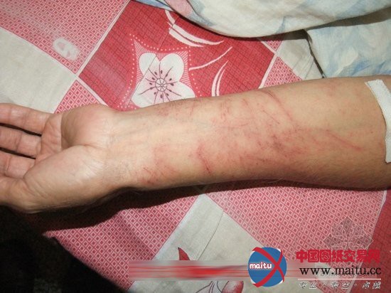 阜南:违法施工竟成“执行职务”