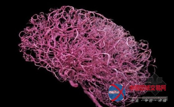 IBM研制“大脑型电脑” 电解液充当血液供电降温